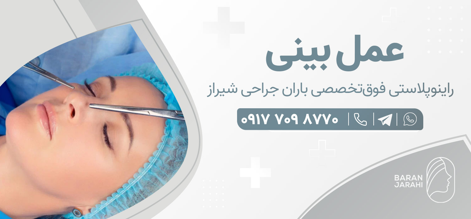 بهترین دکتر عمل بینی شیراز