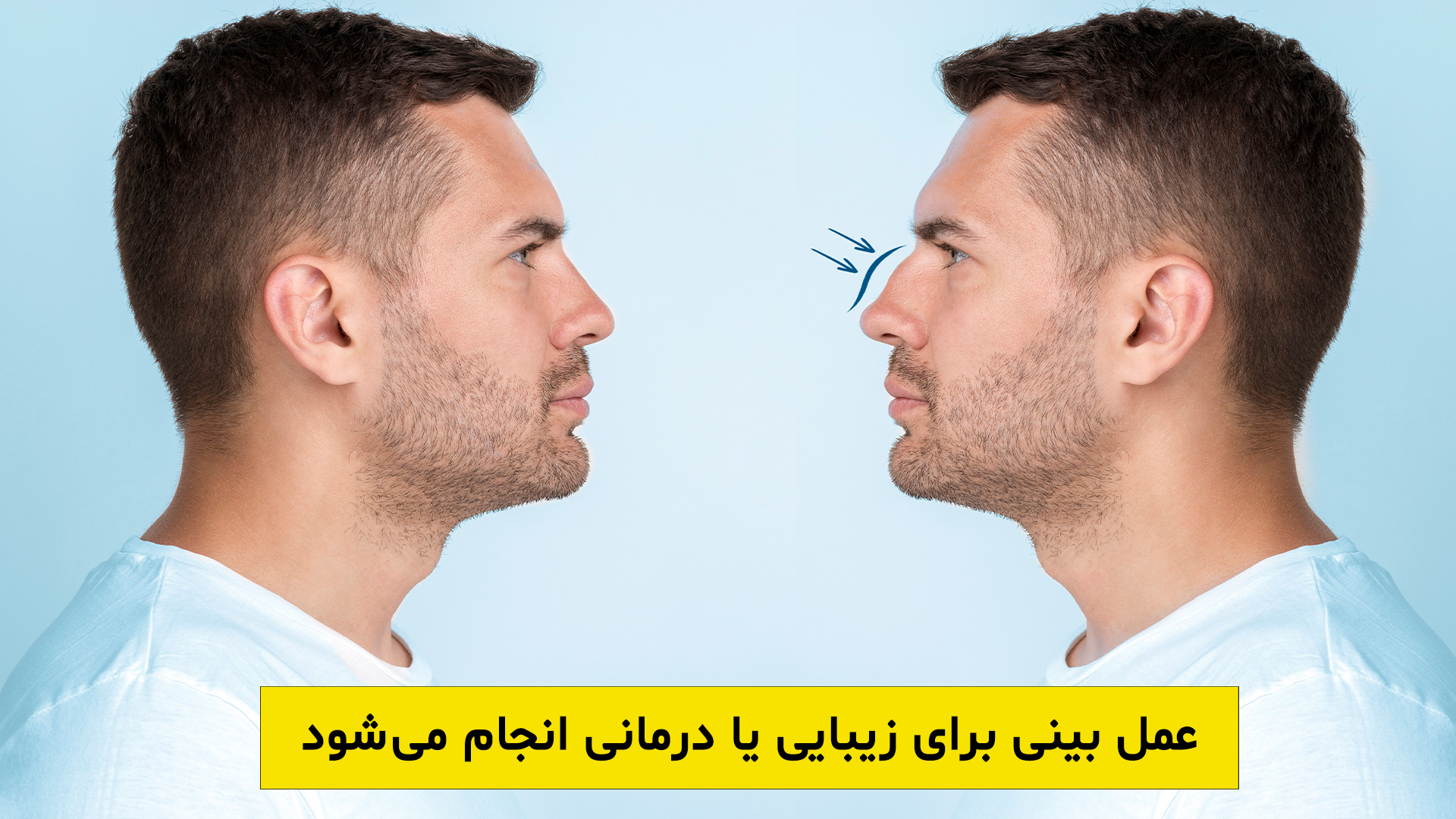 عمل بینی در شیراز با هدف زیبایی یا درمانی انجام میشود