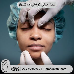 عمل بینی گوشتی در شیراز عمل بینی گوشتی در شیراز